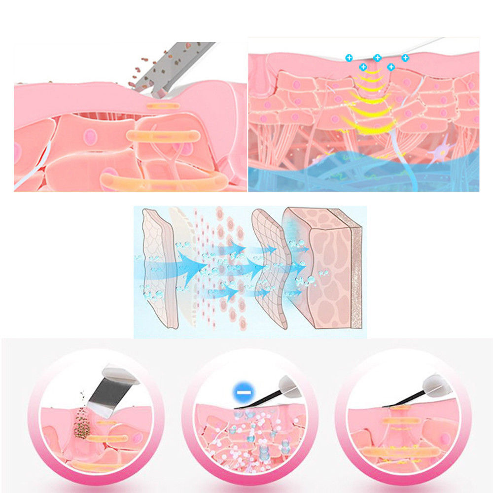 Ultrasonic Skin Scrubber Deep Cleaning Face Scrubber Vibrating Facial Cleansing Skin Spatula Peeling Beauty Instrument D