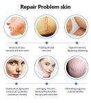 Co2 Laser 10600nm Laser Co2 Fractional Skin Resurfacing Machine