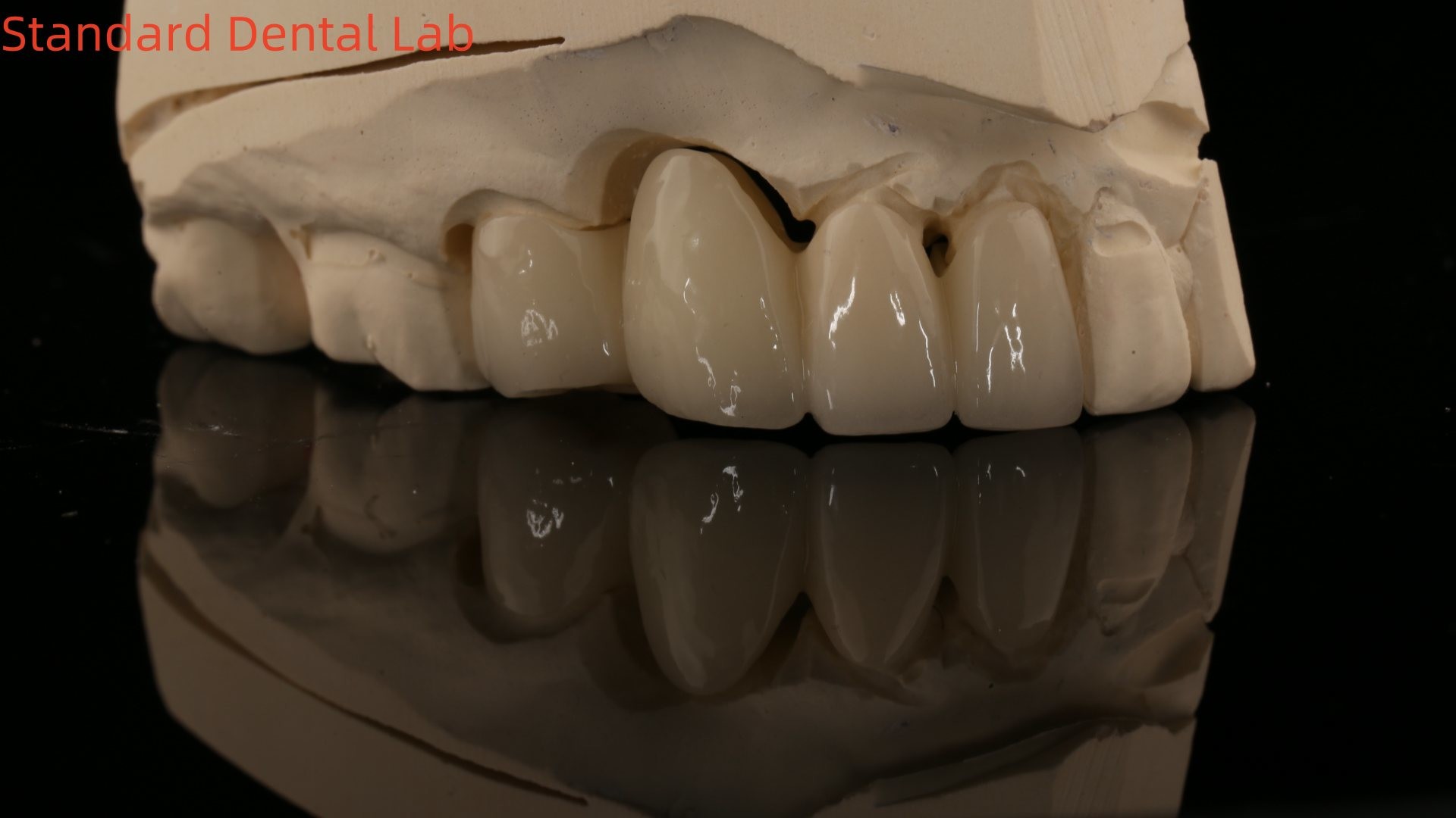 Solid Dental Lab Crowns 3D Pro High Translucency Full Zirconia Crowns with Vita Shade Customized