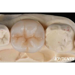 Buy cheap Multilayer Full Zirconia Ultimate Combination Of Strength And Aesthetics For from wholesalers
