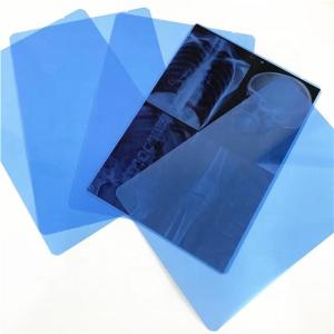 Wholesale 210 Micron 14&quot;X54m Blue X Ray Film Roll For Inkjet Printing from china suppliers