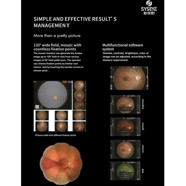Automated Fundus Camera with Images and Multimodal Imaging Options for Small Pupil Imaging and Easy Operation