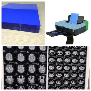 Wholesale Long Lasting Inkjet X Ray Film With Low Fog And High Printing Quality 150 Microns from china suppliers