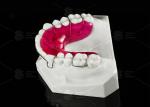 Comfortable Stainless Steel Acrylic Hawley Retainer Effective Orthodontic