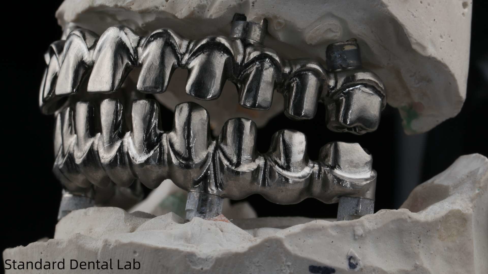 Dental Hybird Malo Implant Bridge Professional Perfect Fit FDA Certified