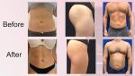 Beauty Salon EMS Slimming Machine Desktop Type For Weight Loss / Skin Tightening
