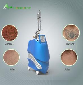 Wholesale PICOSURE Nd:YAG laser for tattoo removal, Ota removal; Acne removal; Tattoo removal from china suppliers
