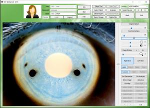 Wholesale 12.0MP Digital Iriscope Iridology Camera Eye Testing Machine CE/DHL Approval from china suppliers