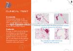 Factory wholesale hifu korea Non-surgical body slimming hifu Liposonix machine