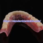 High Esthetics Dental TCS Valplast Flexible Partial Dentures Dental Lab Valplast