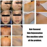 IPL 2 Handles Skin Rejuvenation Acne Treatment Vascular Hair Removal Machine