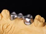 Audental 04 Noble Alloy Silver-Palladium Porcelain Alloy White Pd53.3% for Long