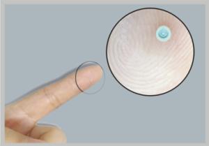 Professional Contract Precision Injection Molding For Medical Device Parts