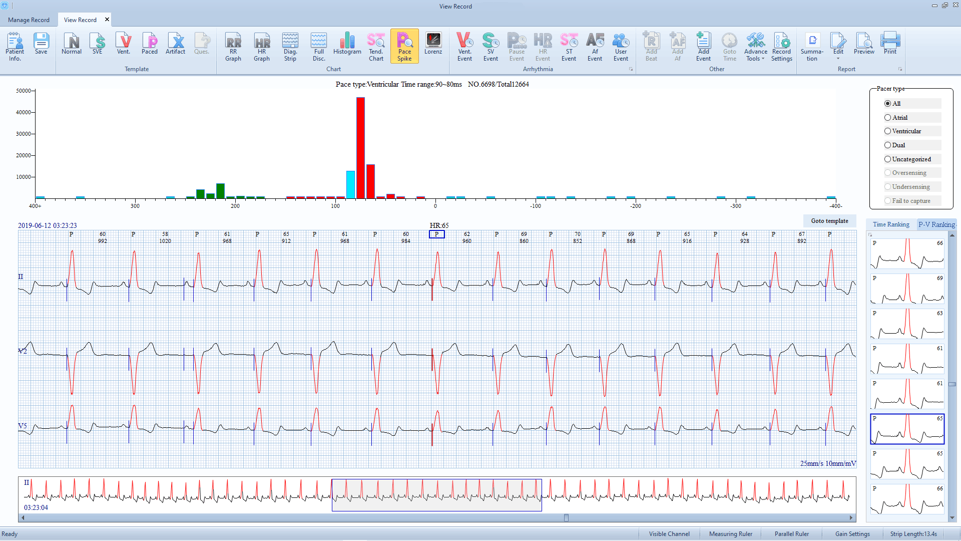 Digital Twelve Channels ECG Holter 24 Hours ECG Data Record Standard Electrocardiogram HT06