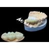 Buy cheap Natural Color Zirconia Dental Crown Crack Resistant For A Flawless Smile from from wholesalers