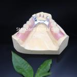 Acrylic Metal Partial Denture Frameworks High Esthetics SDL dental lab