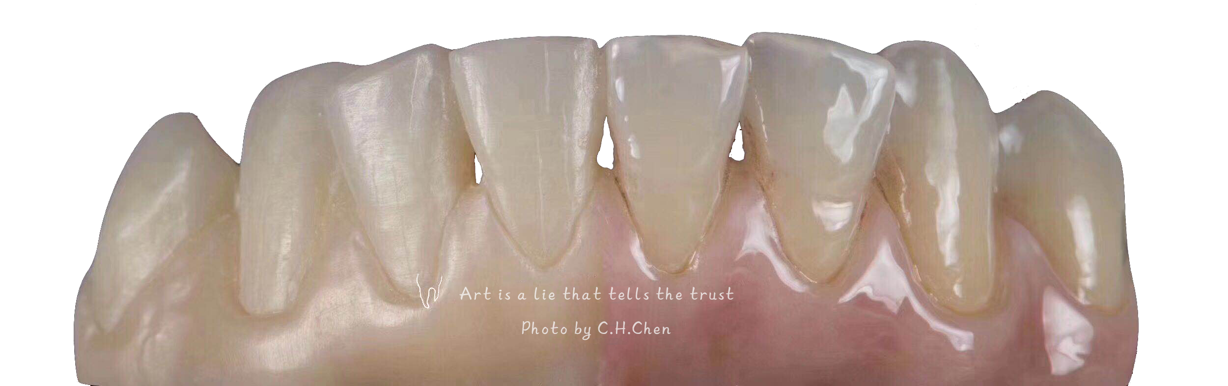 D98 Open System Zirconia Blocks Upcera 4D Explore