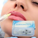 Female Gel Injectable Dermal Fillers Anti Aging Fillers For Mouth Wrinkles