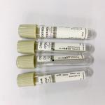 Accurate Ratio Glucose Blood Tube Grey Cap Sodium Fluoride EDTA 1:9