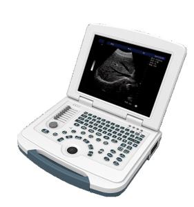 Wholesale Multilingual USB Port Color Doppler Ultrasound Scanner from china suppliers