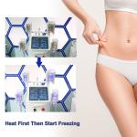 Cool Tech Body Vacuum Suction Cellulite Lipolysis Vacuum Sculptor Fat Freezing