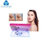 Dermal Lip Fillers Anti Aging Lyft 1ml