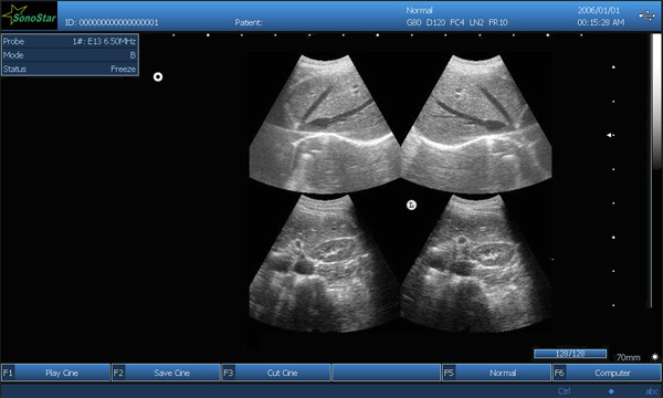 PC based 3D Ultrasound Machine SS-9 Laptop Ultrasound scanner