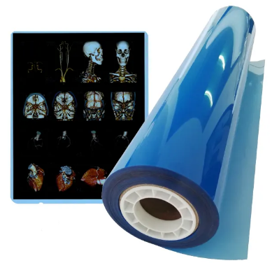 Low Fog A4 Blue PET Dry Pigment Inkjet 210 Micron Medical X Ray Film Eco Friendly