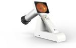 Portable Handheld Wifi Digital Ophthalmoscope For Eye Fundus